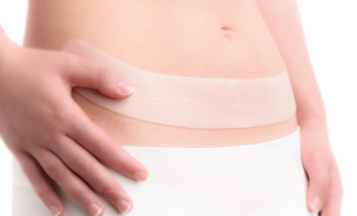 Applying Scarban silicone sheet to lower abdomen for scar treatment after surgery or C-section