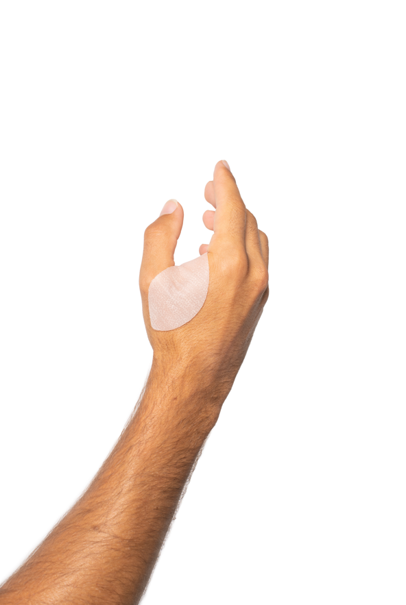 Applying Scarban silicone scar sheet to hand webspace.