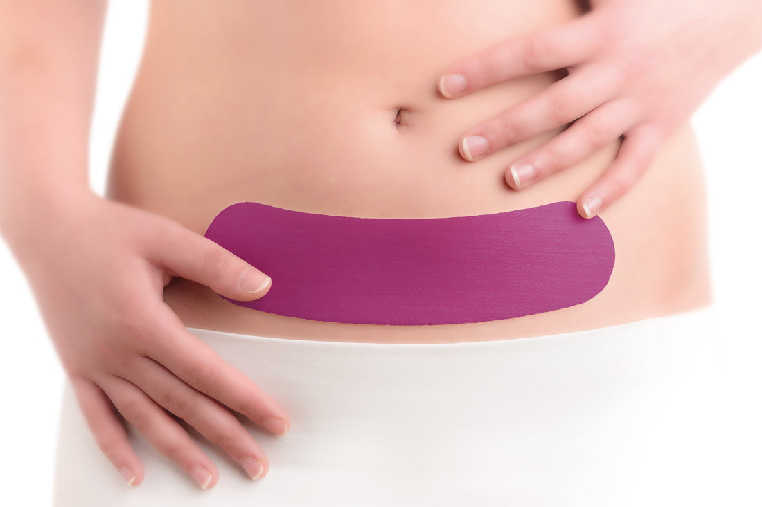 C-Section Recovery in NZ: How Scarban Heals and Fades C-Section Scars