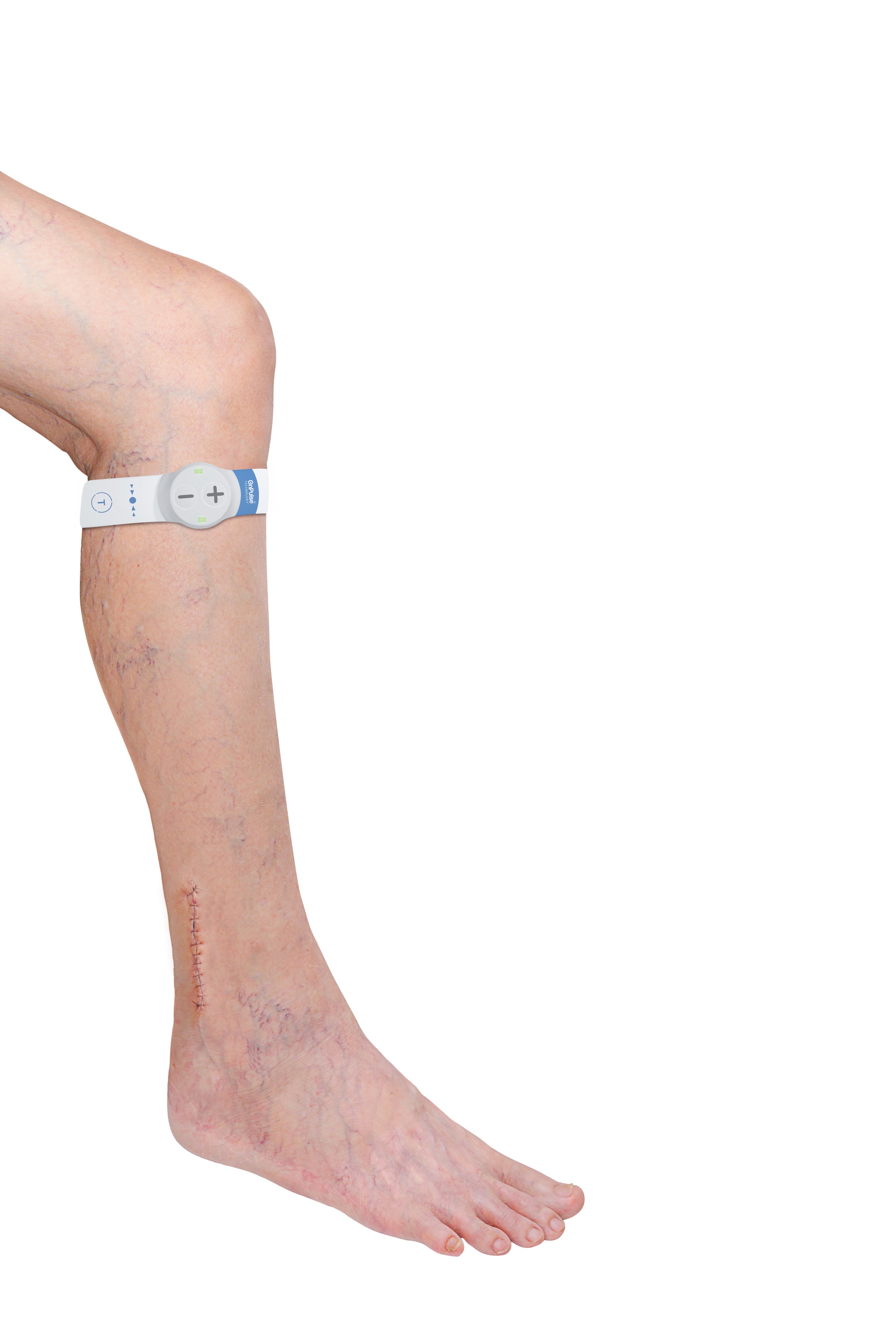Geko™ T3 Neuromuscular Electrostimulation - VTE Propholaxis & Odema Management Device