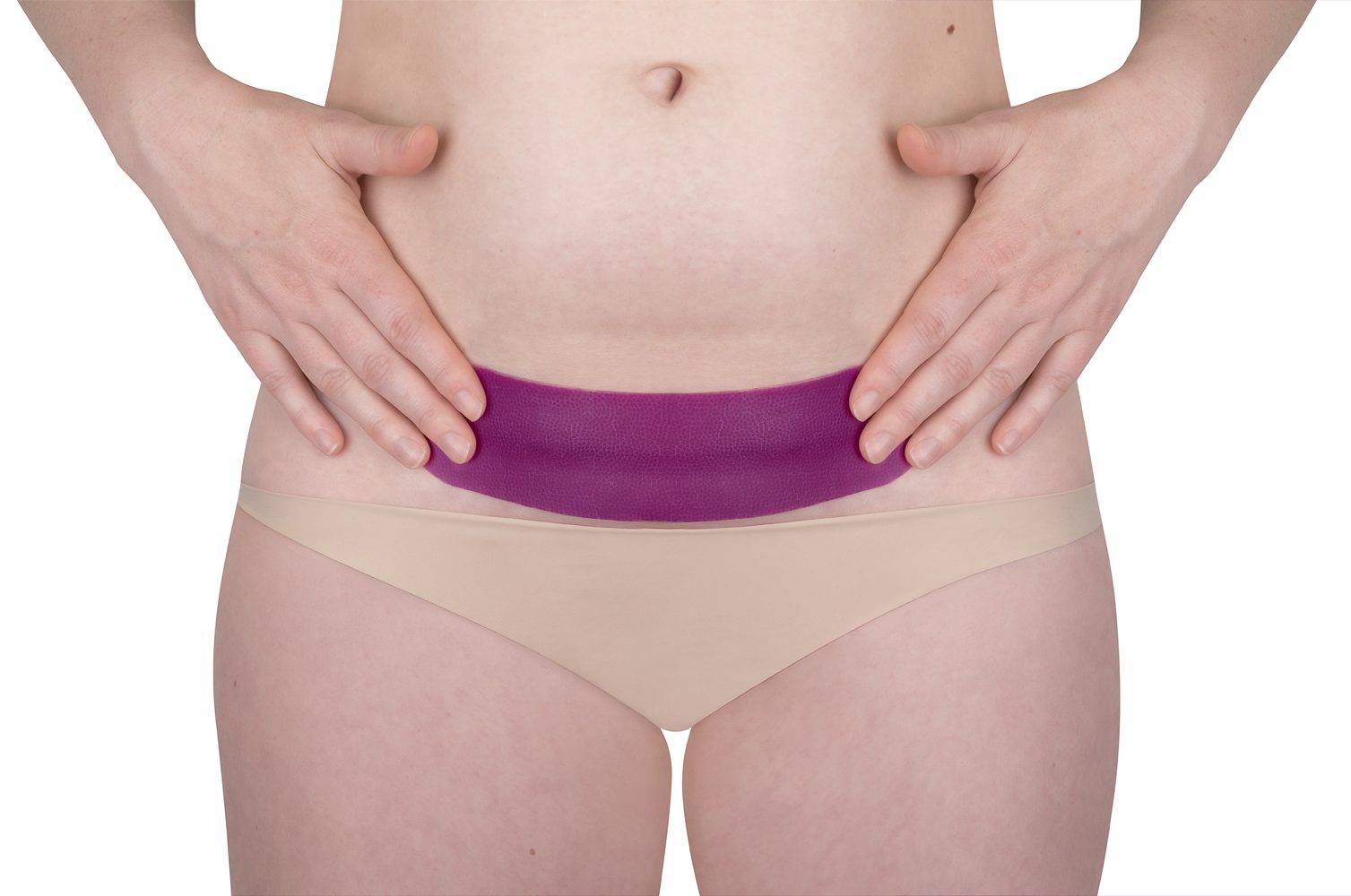 Scarban C-Section Recovery Kit – Silicone Sheets for C-Section Scars