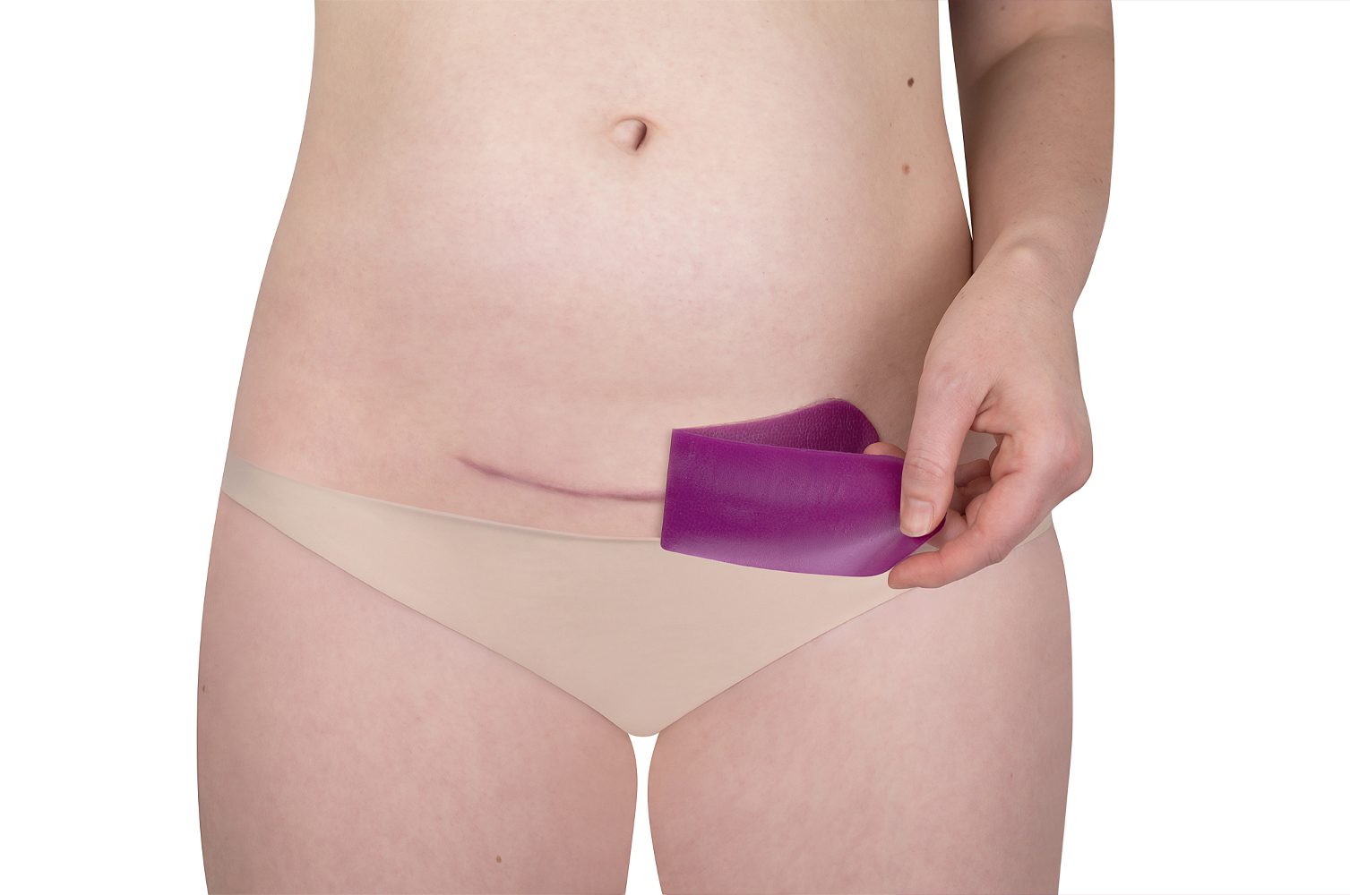 Scarban C-Section Recovery Kit – Silicone Sheets for C-Section Scars