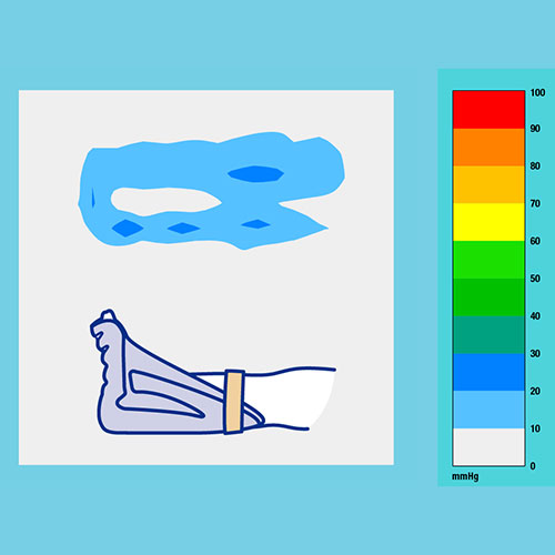 Levabo Heel Up Medium (Box of 12) - On SALE 50% Off (Free Pump Included)